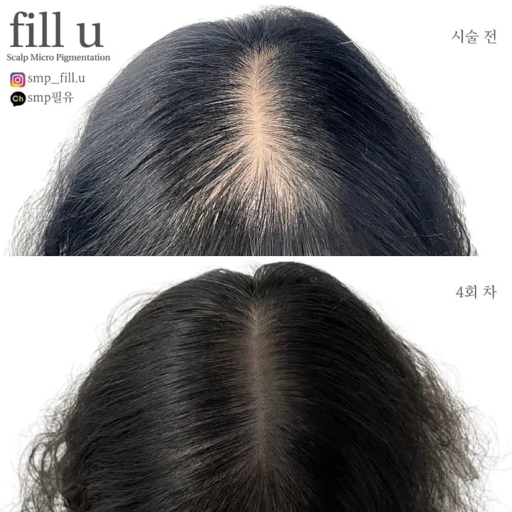 ๊ฐ๋ฅด๋ง ์ปค๋ฒ ๋ฐ๋๋ณด๊ฐ SMP ๋ํผ๋ฌธ์