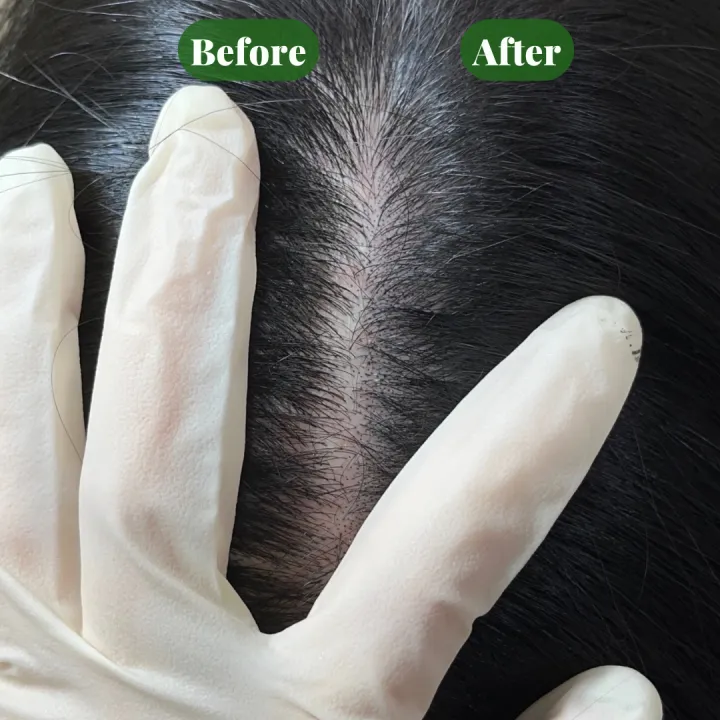 ๋ํผ๋ฌธ์ ์ด๋ฒคํธ ์ค