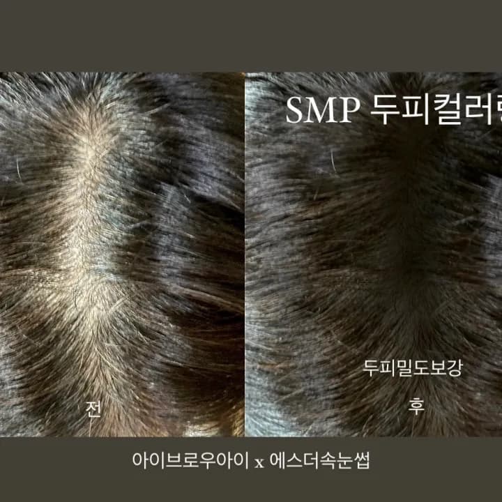 SMP 두피컬러링