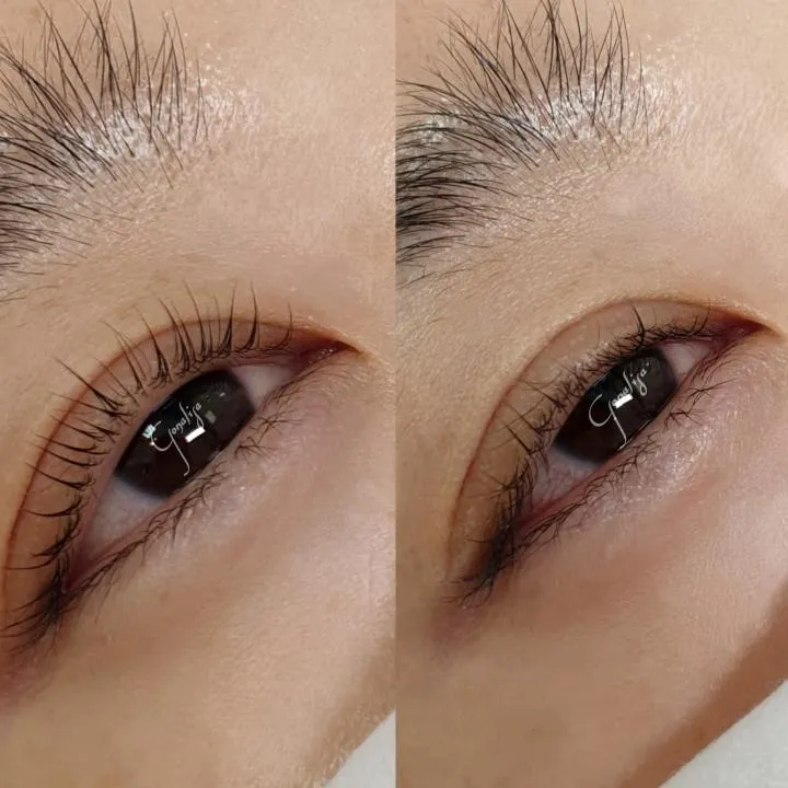 ๋
ธ๊ธ๋ฃจ ์๋์น ๋ณต๊ตฌํ