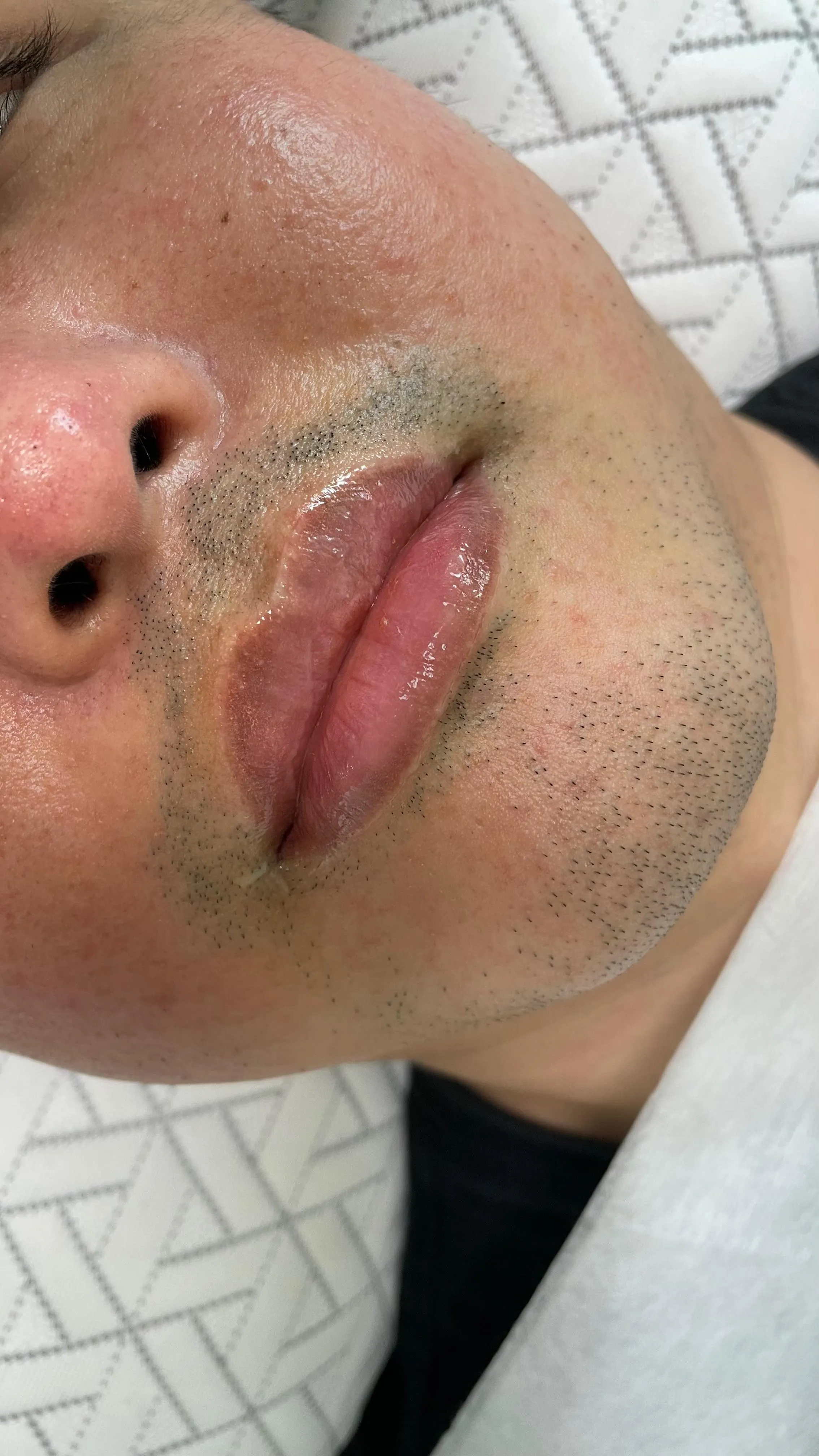 어두운 남자입술 톤업 - 1