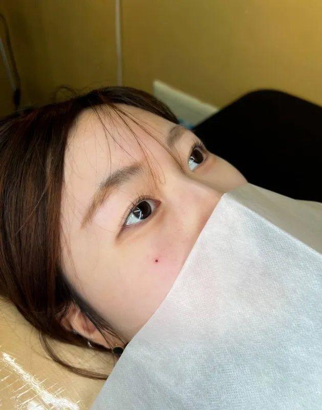 미인점