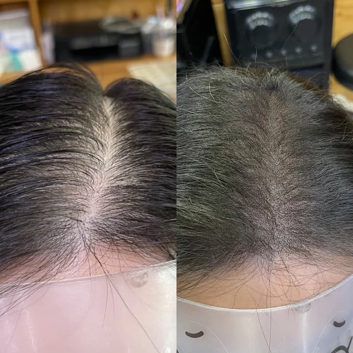 ์ ์๋ฆฌํ๋ชจ์ปค๋ฒ