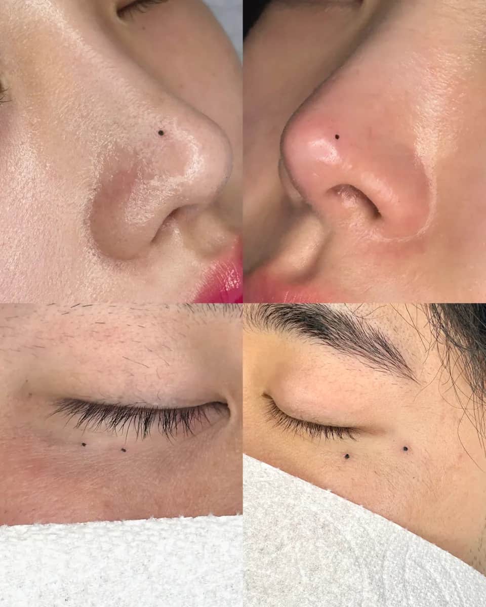 ๋ฏธ์ธ ์ ํํฌ