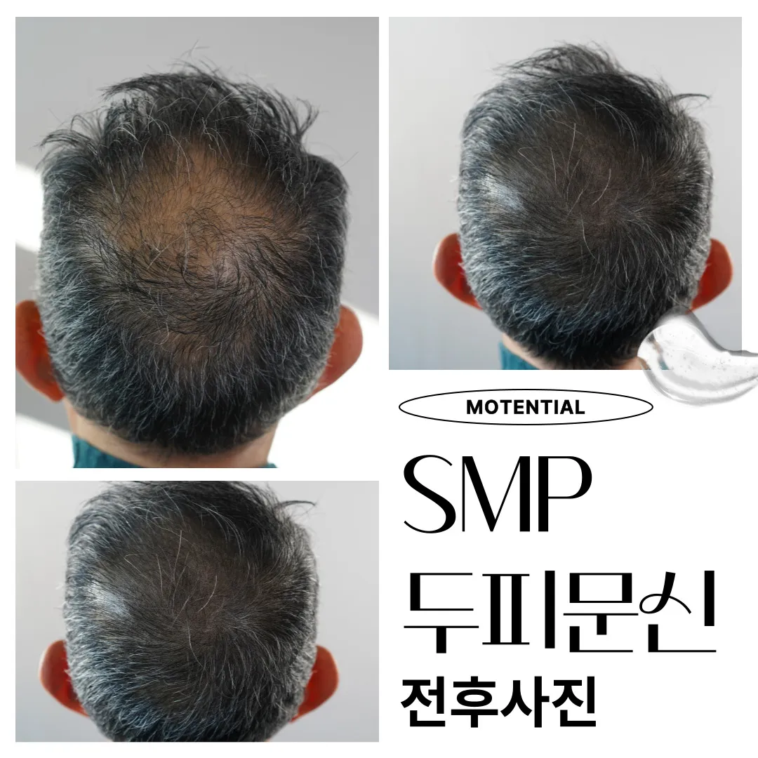 ๋ท์ ์๋ฆฌ ๋ํผ๋ฌธ์ smp