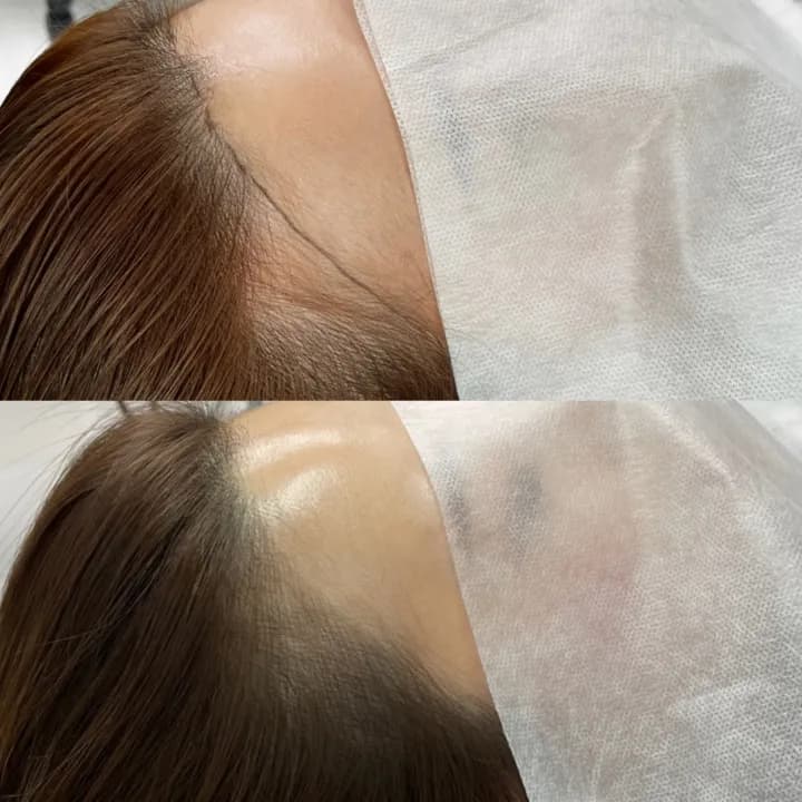 ๋ผ์ธ๊ธฐ๋ฒ