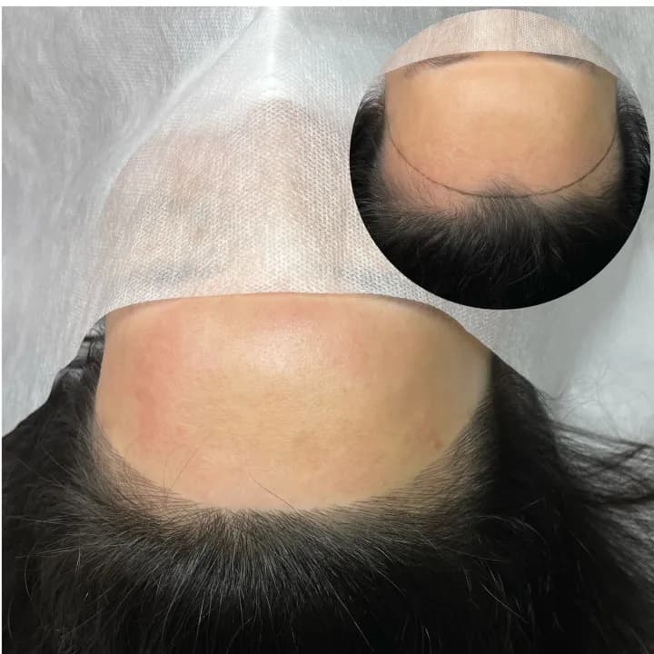 ํค์ด๋ผ์ธ ๋ผ์ธ๊ธฐ๋ฒ