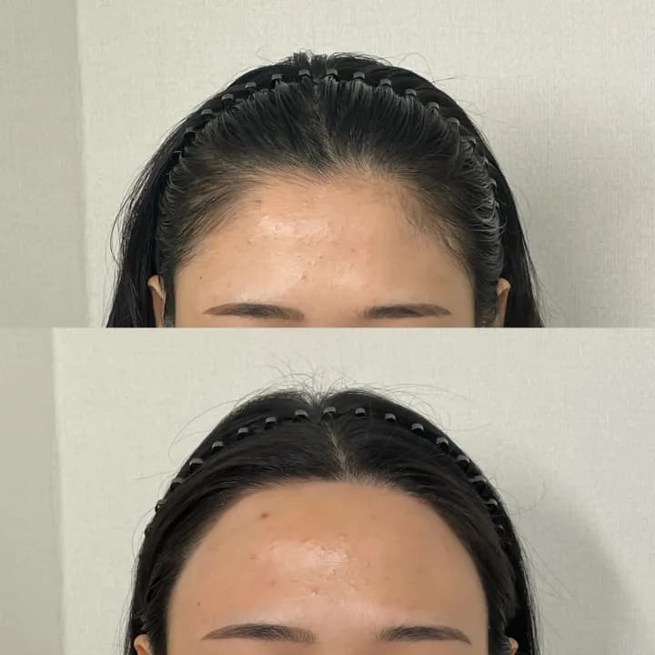 ํค์ด๋ผ์ธ ๋ผ์ธ๊ธฐ๋ฒ