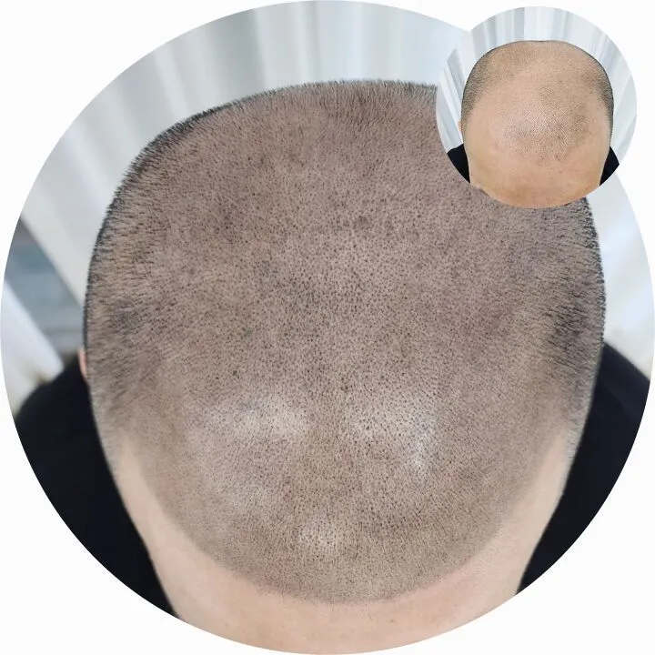 ์ญ๋ฐ๋์์ธsmp