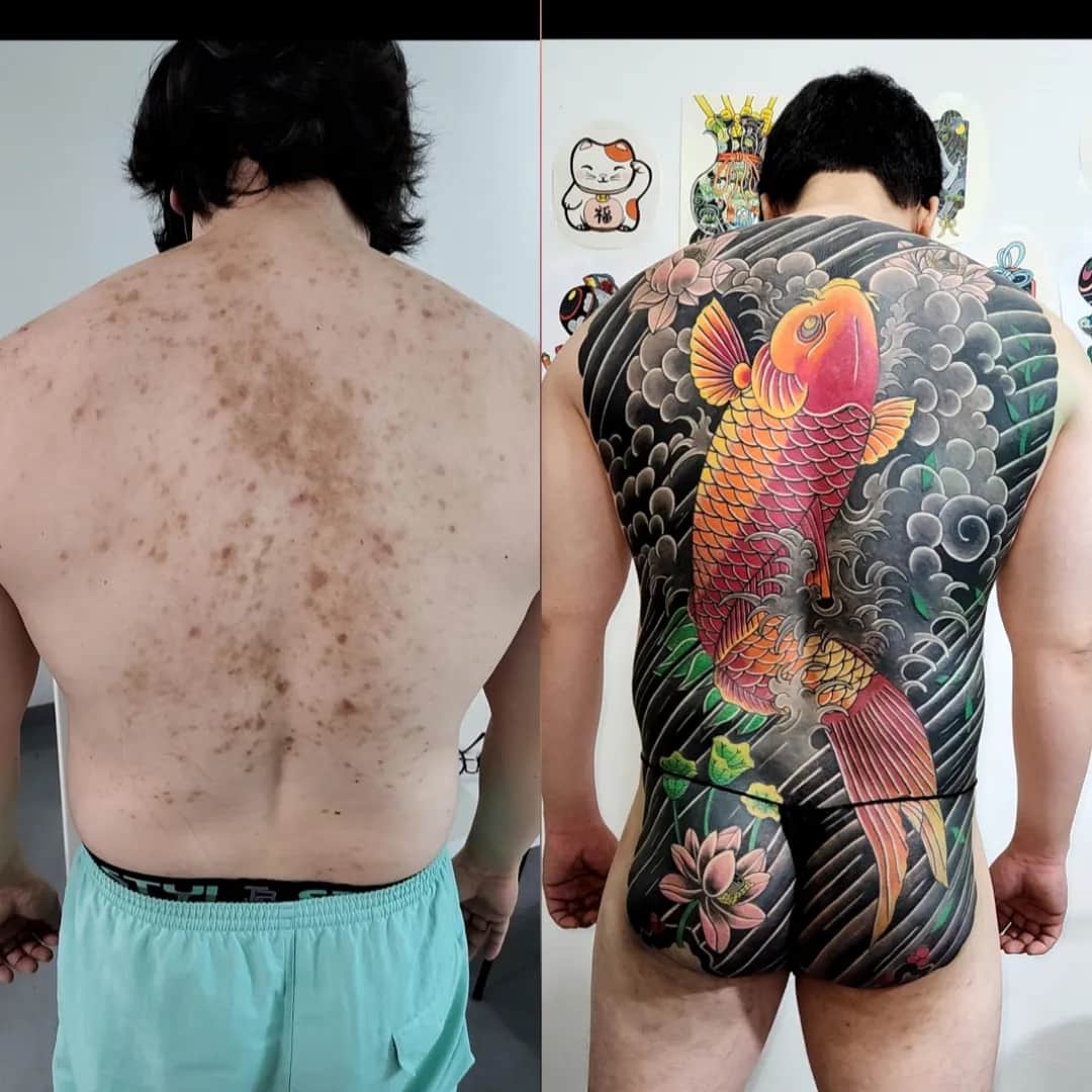 흉터커버업