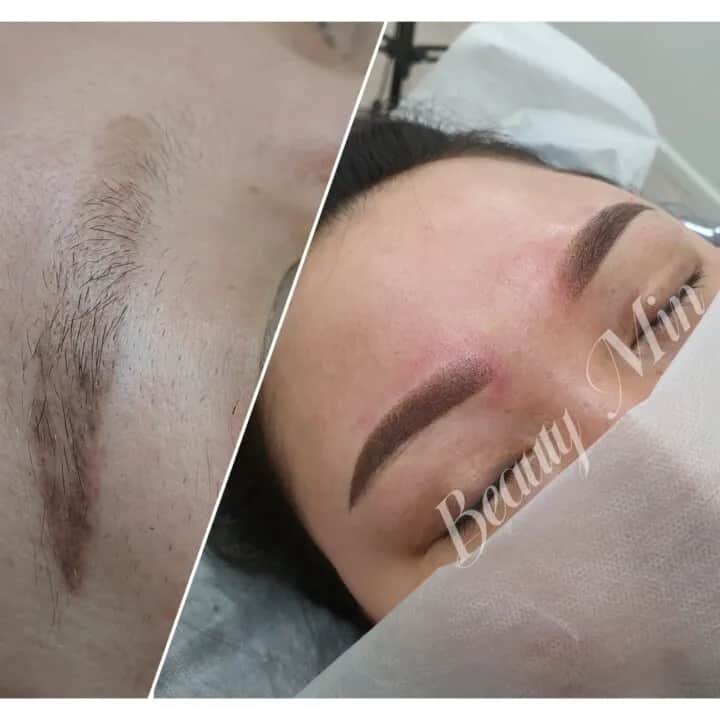 여자 눈썹 수정 커버업