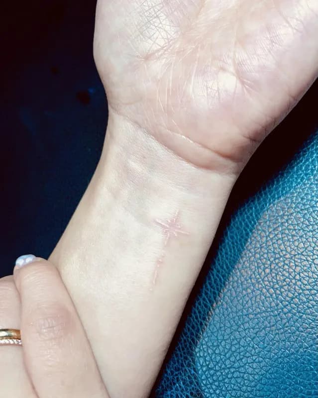 ํ์ดํธ ํํฌ