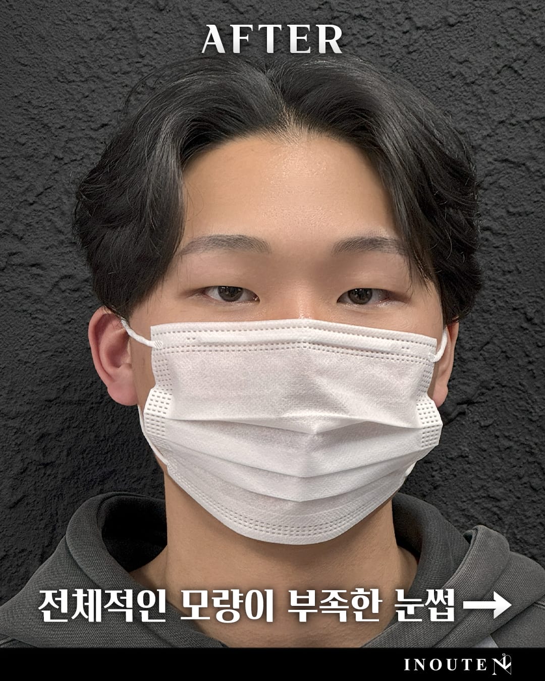 ๋ธ๋ก์ฐ ์ปจ์คํ
(B/A)