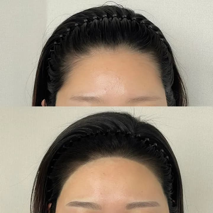 ํค์ด๋ผ์ธ ๋ผ์ธ ๊ธฐ๋ฒ