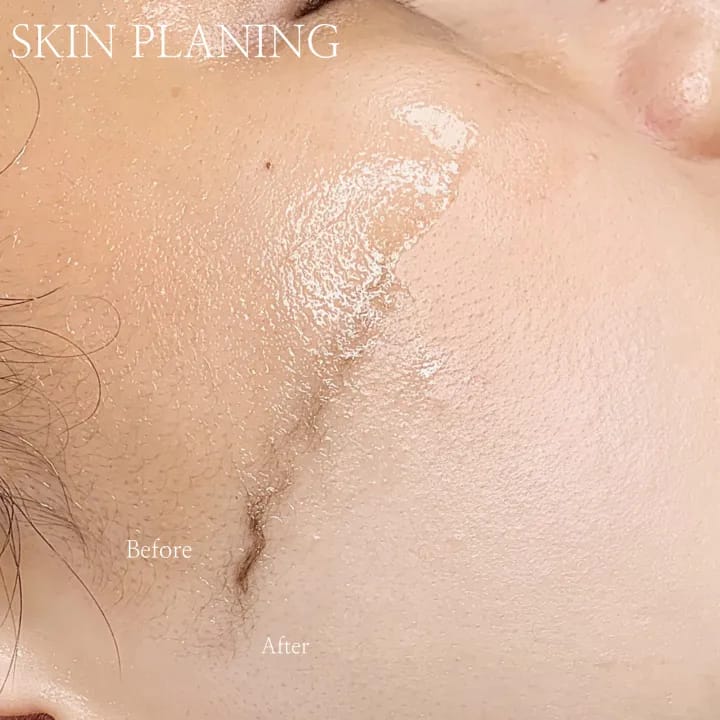 ์คํจํ๋๋