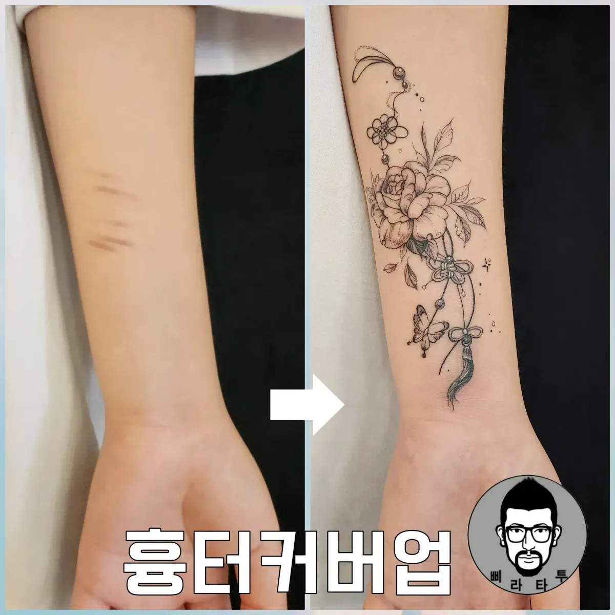 노리개와 꽃(흉터커버업)