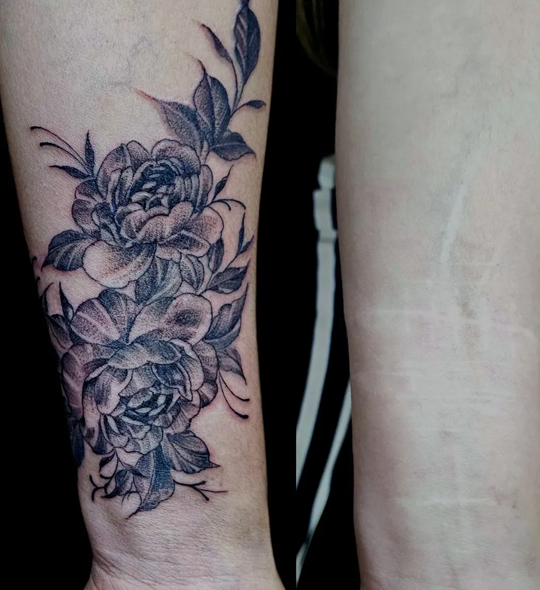 ์ปค๋ฒ์
ํํฌ,์์ฐํํฌ,์ํฅํํฌ,๊ด๋ช
ํํฌ,๋ฐฐ๊ณงํํฌ,๋จ์ํํฌ,ํ์ฑํํฌ