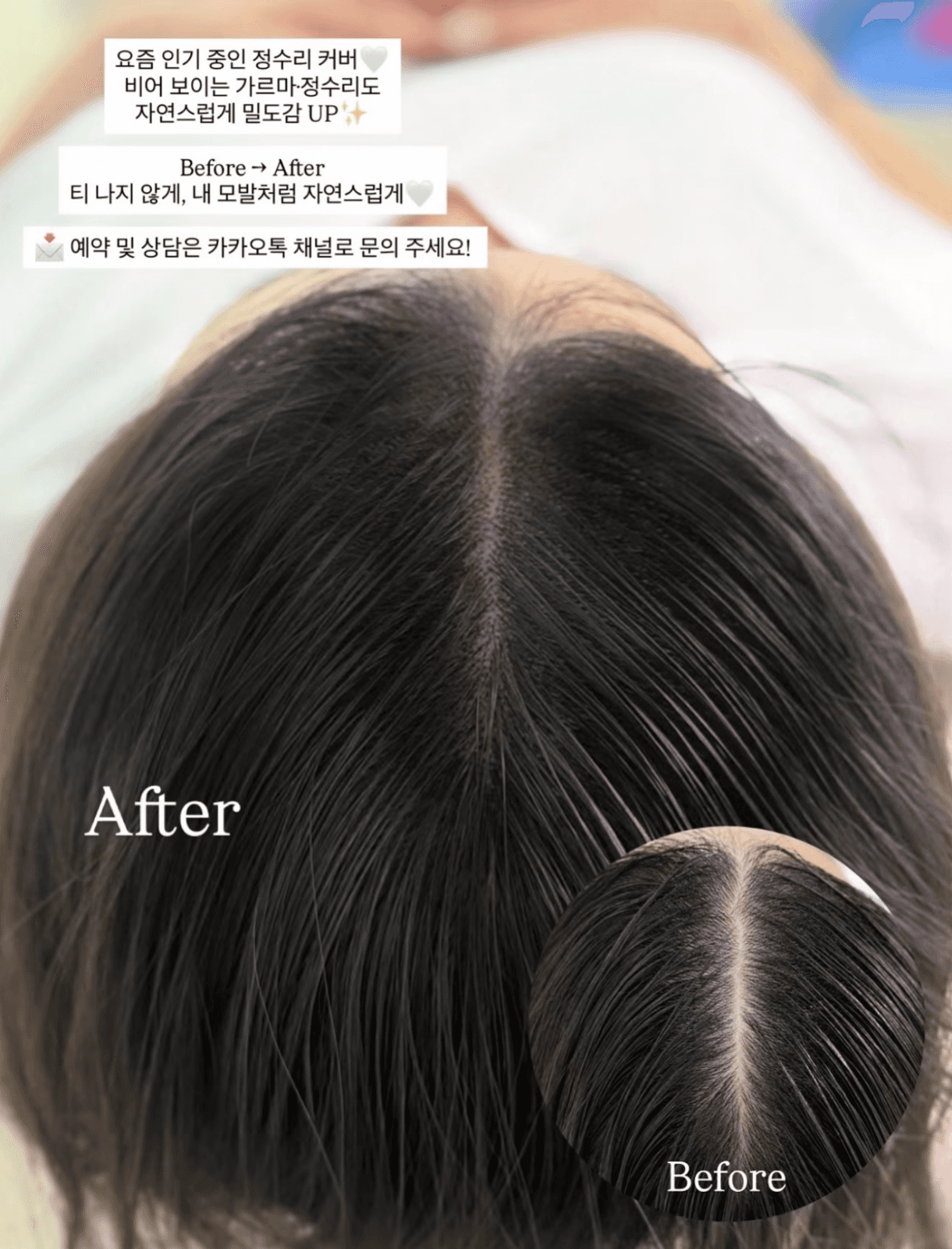 가르마·정수리 커버|비어 보이는 두피 자연스럽게 채우기