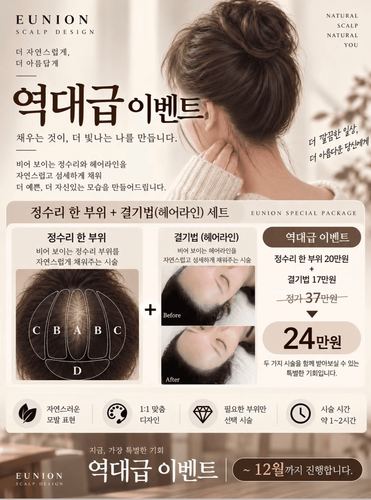 정수리+헤어라인 한번에! 자연스럽게 채우는 특별 패키지