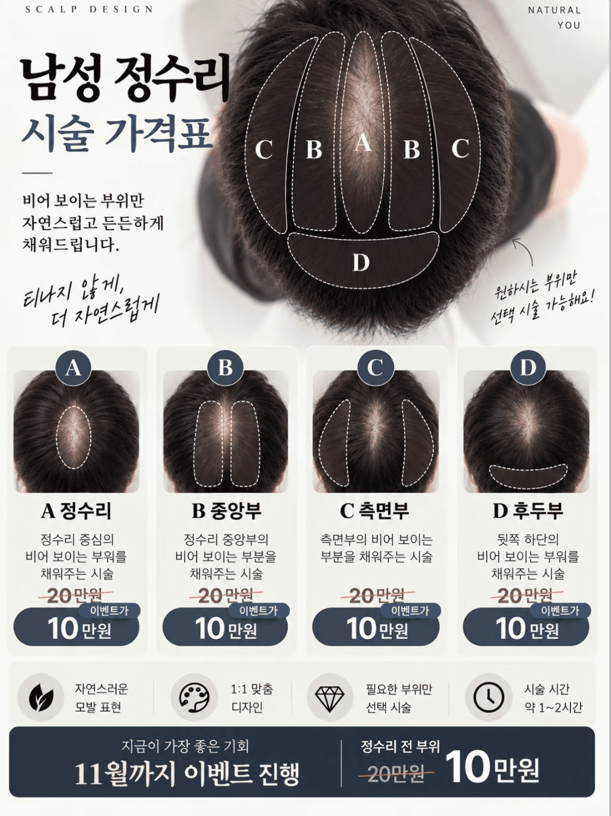 남자 정수리 고민, 필요한 부위만 깔끔하게 커버!
