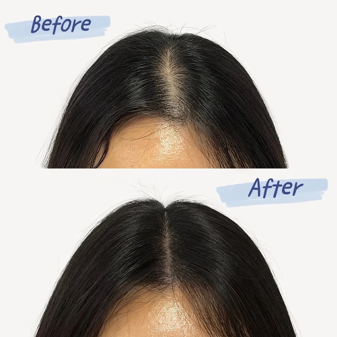 여성 가르마 탈모커버